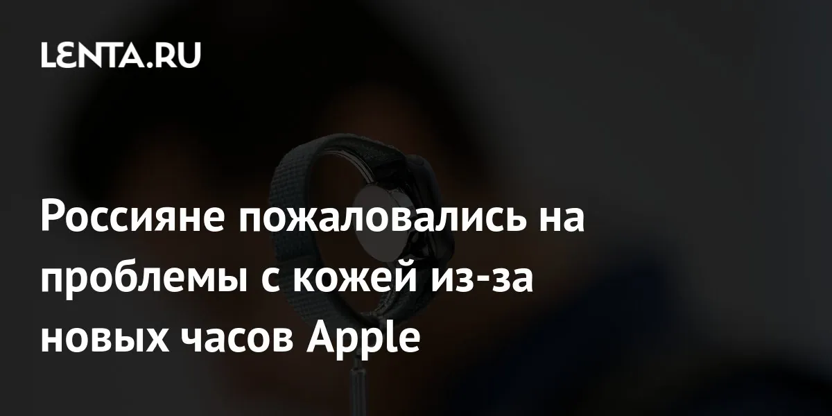 Lenta.ru reports skin-irritation complaints from new Apple Watch owners
