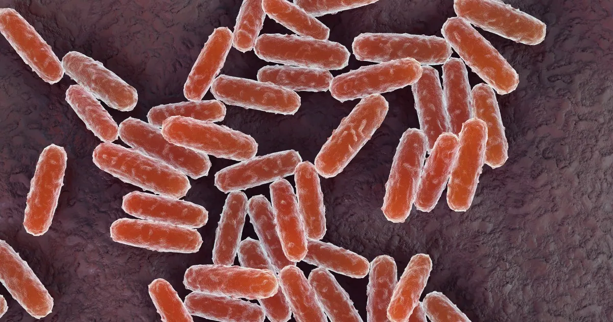 Cause of Siberian lab worker’s death remains unclear amid plague questions