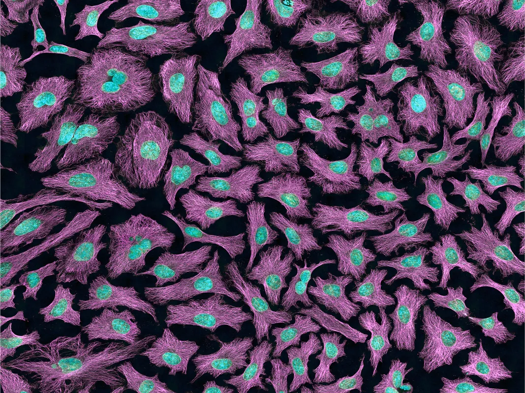 AI in scientific imaging raises questions over what algorithms add